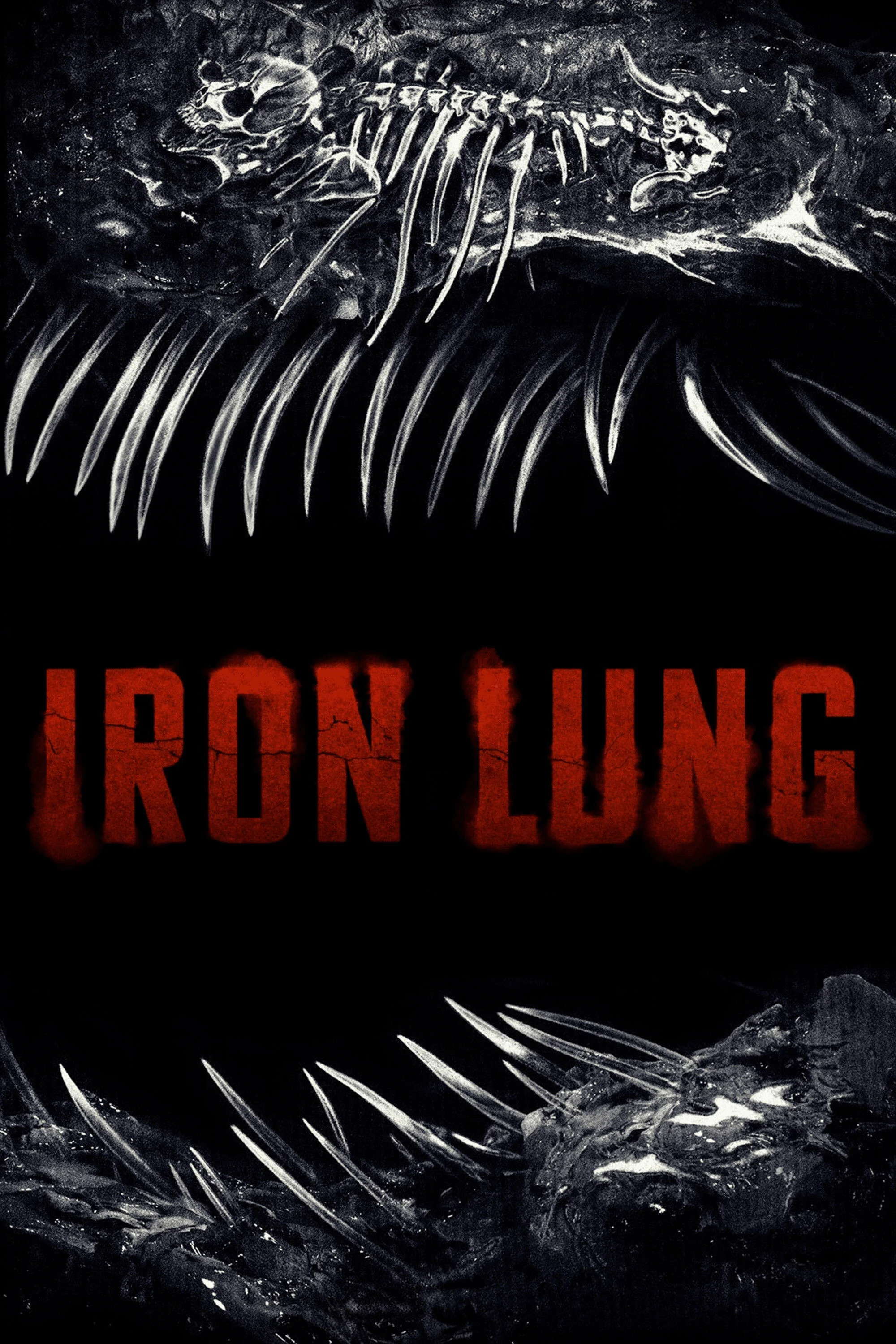 Phổi Sắt Iron Lung